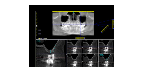 Case 14 - img2