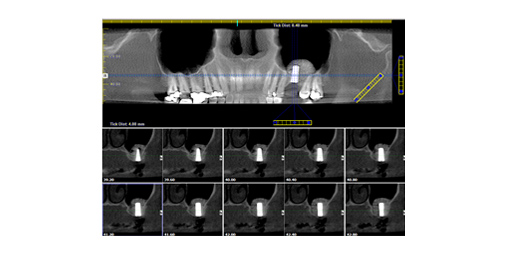 Case 14 - img5